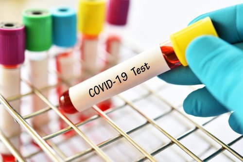 Singapur'da yeni tip Covid-19 hızlı tanı test reaktifleri